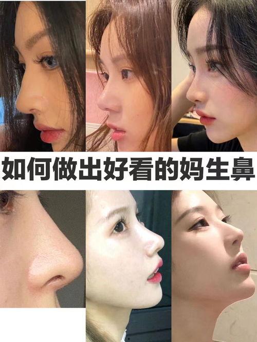 好看的网红鼻,揭秘时下最受欢迎的鼻型美学